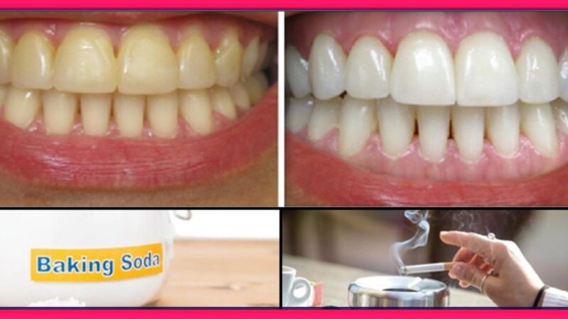 काय आपले पण दात पिवळे किंवा लाल पडले आहेत…तर आजच करा हे घरगुती उपाय…काही क्षणात आपले दात हिऱ्यासारखे चमकतील