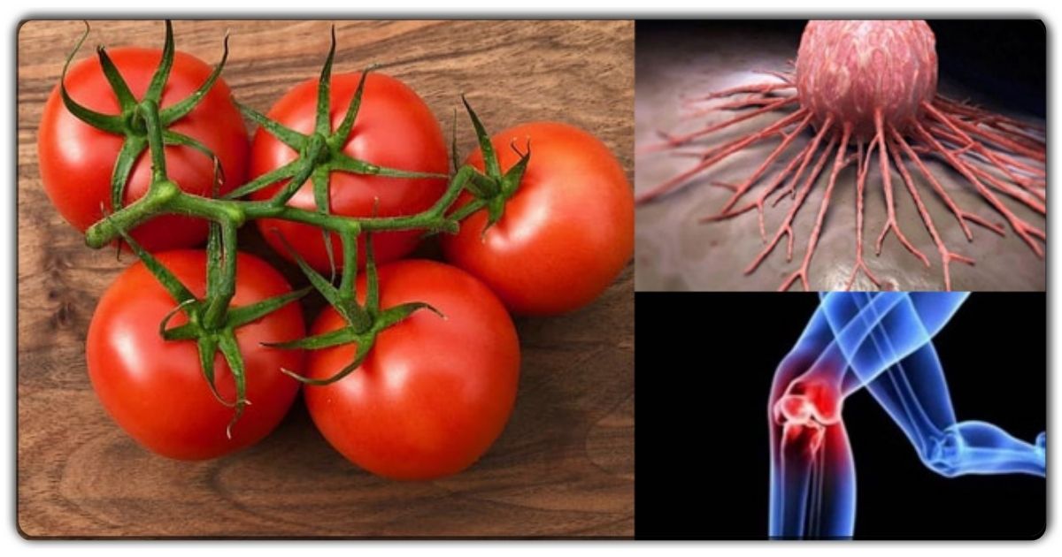 टोमॅटोचे सेवन केल्याने आरोग्यास बर्‍याच उत्कृष्ट फायदे मिळतात, त्याच्या प्रचंड फायद्यांबद्दल जाणून घ्या